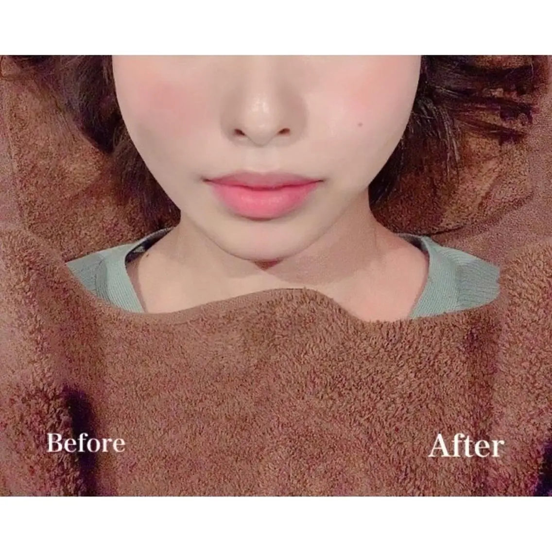 美容鍼灸サロン LOMIHARIのエステ・リラクイメージ