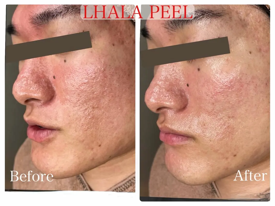 エステ 佐々木 風奈のエステ・リラクイメージ