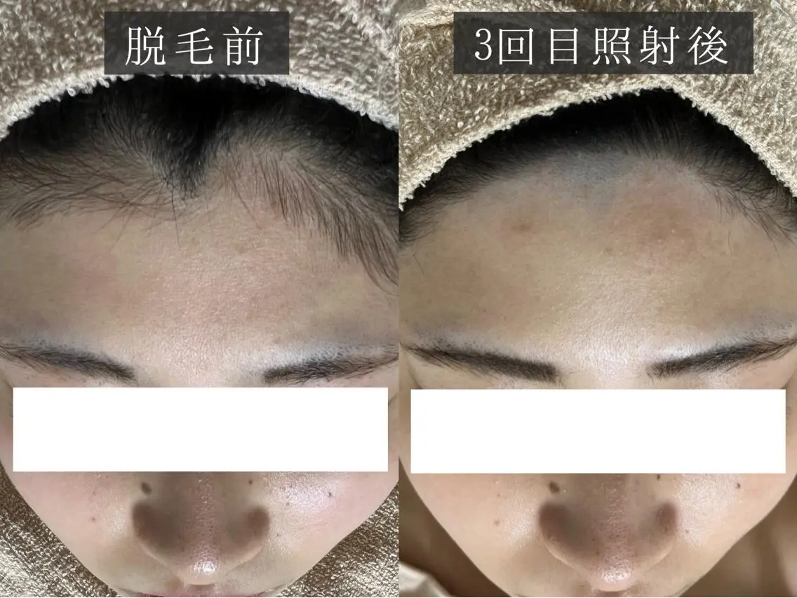 脱毛 脱毛専門サロン BELFINE恵比寿のエステ・リラクイメージ