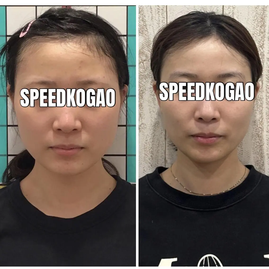 エステ リラク 小顔矯正Speed KOGAO渋谷本店のエステ・リラクイメージ