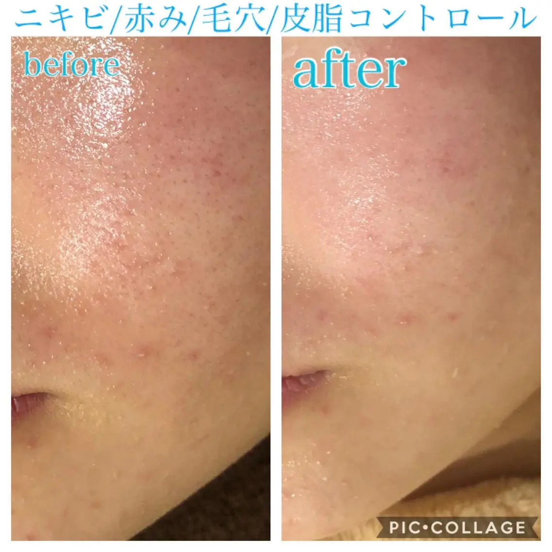 ロング カラー パーマ ヘアアレンジ キッズ ネイル マツエク・マツパ エステ リラク EnsorClair 代表　野口真央のエステ・リラクイメージ