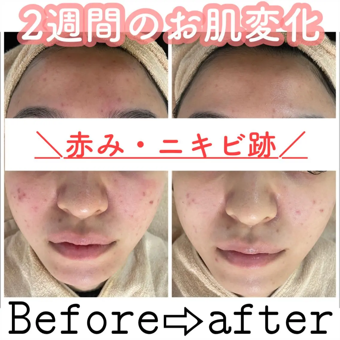 セミロング カラー パーマ ヘアアレンジ メンズ キッズ ネイル マツエク・マツパ エステ ニキビ&跡改善サロン オーナー光木のエステ・リラクイメージ