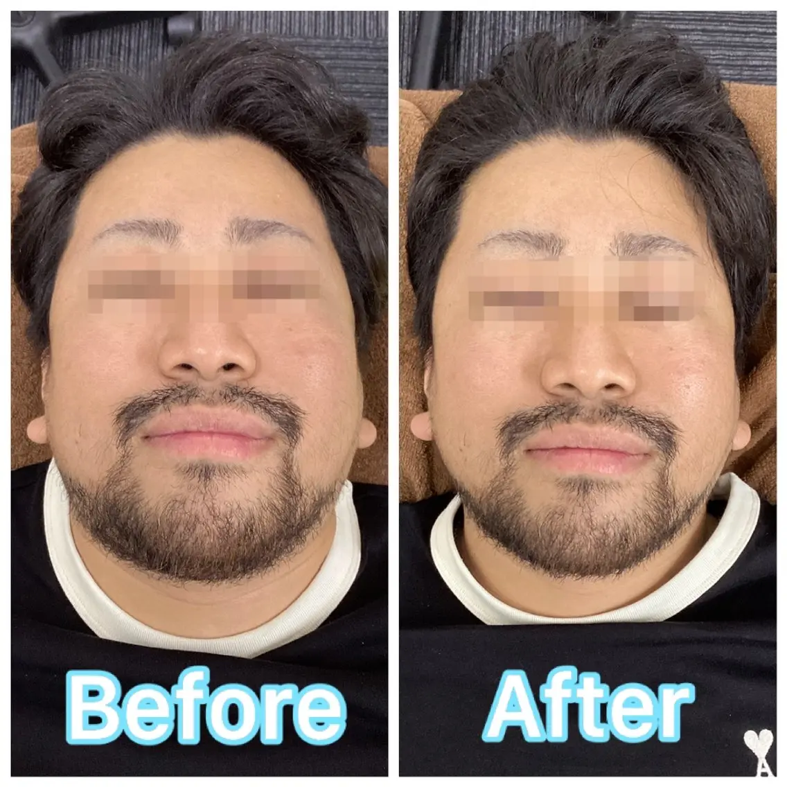 エステ リラク Beauty sal on Ren⭐️立谷のエステ・リラクイメージ