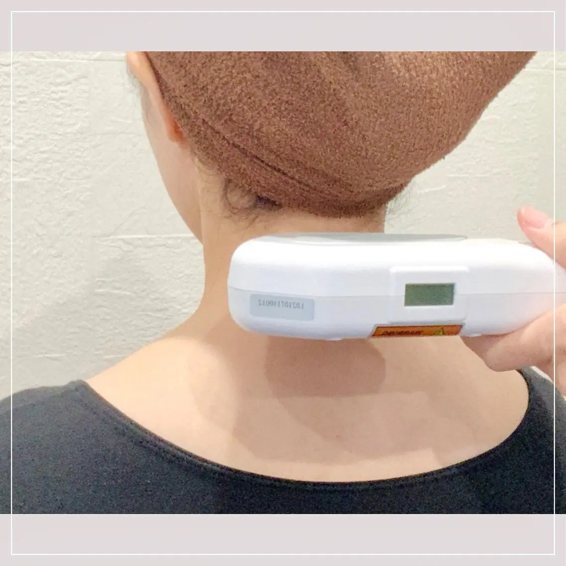 うなじの脱毛の写真
