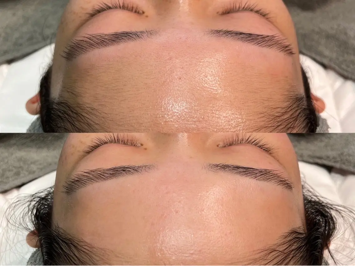 フルフェイスWAX脱毛×贅沢パック付⭕️の写真