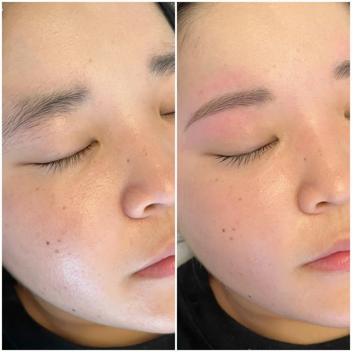 【期間限定キャンペーン】うなじWax➕眉Waxですっきり首長・横顔まで綺麗✨洗練された眉と後ろ姿美人に✨🪽の写真