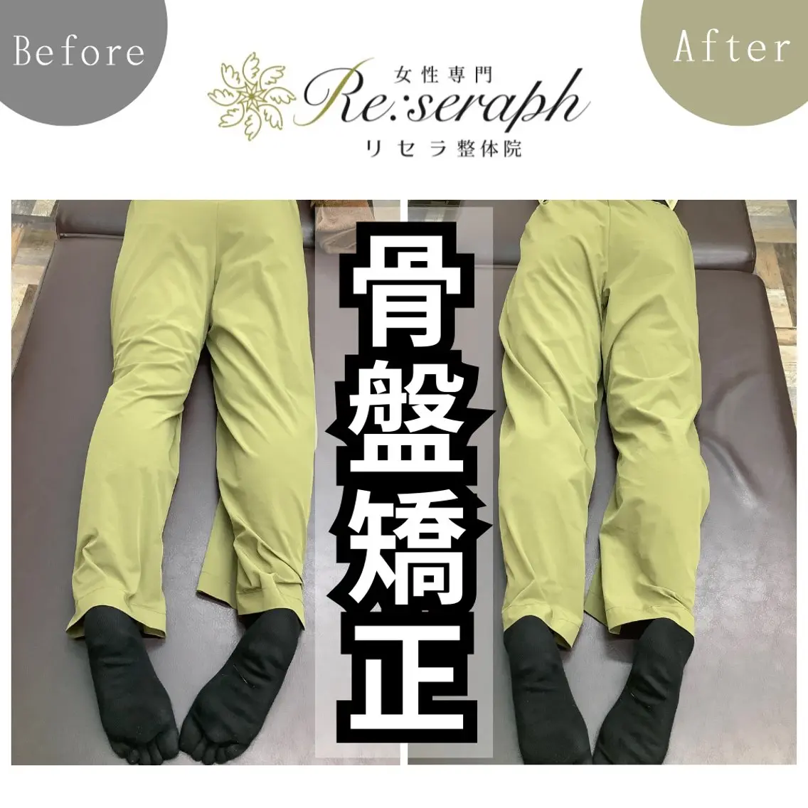 【下半身太り・腰痛・歪み改善】骨盤矯正💎初回¥4980の写真