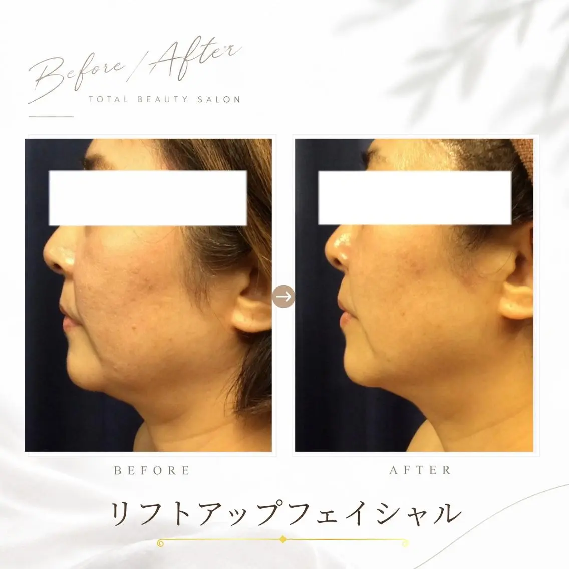 《 肌質×美肌 》 addissimoのエステ・リラクイメージ