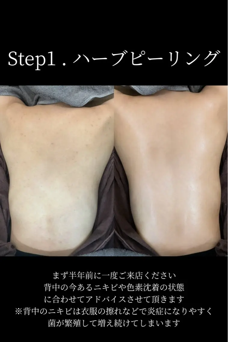 艶肌デトックス🫧 Samiraのエステ・リラクイメージ