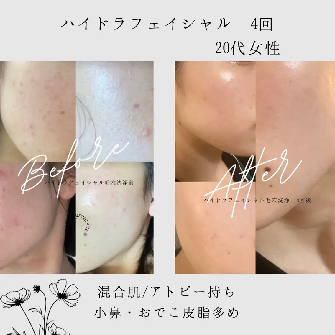 【肌質改善・腸揉み】 Nico laughのその他イメージ