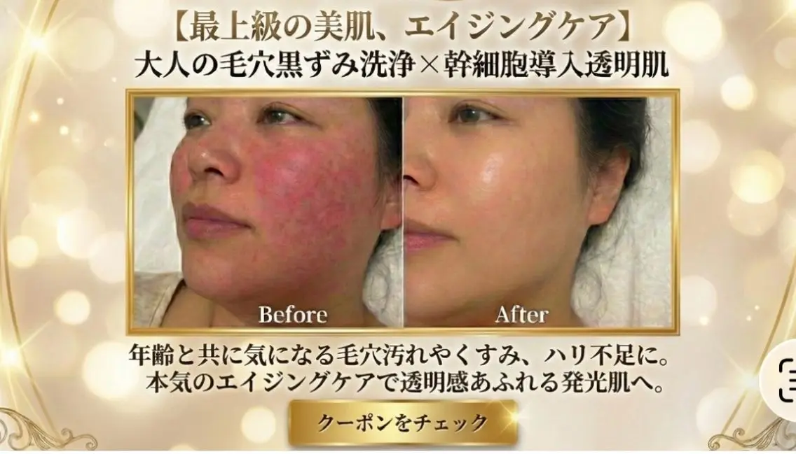 【毛穴×美白】大人の黒ずみ洗浄+高濃度ヒト幹細胞|陶器肌・エイジングケア・ざらつき除去【施術60分】の写真