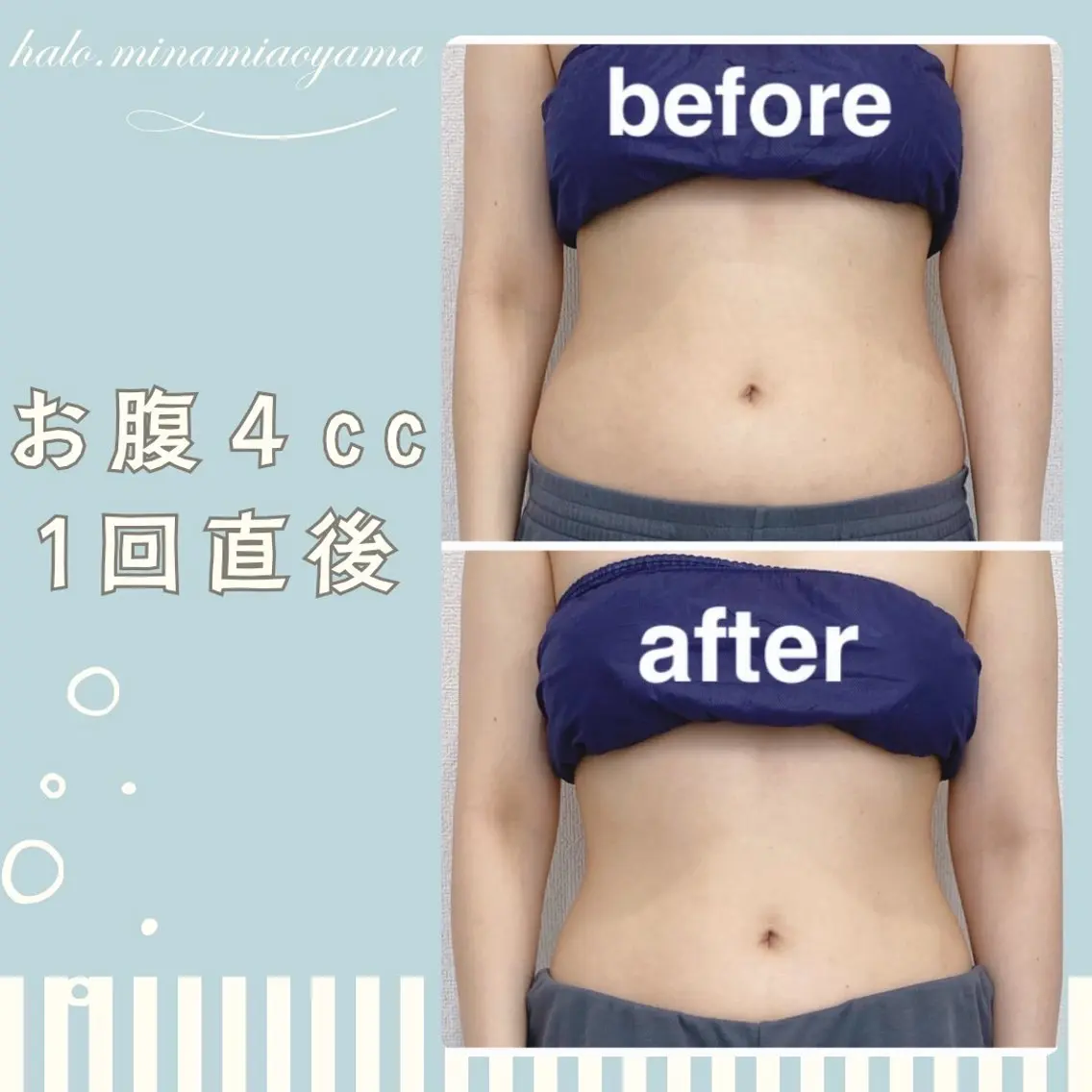【ミニモ限定】お腹ウエスト集中お試し60分の写真