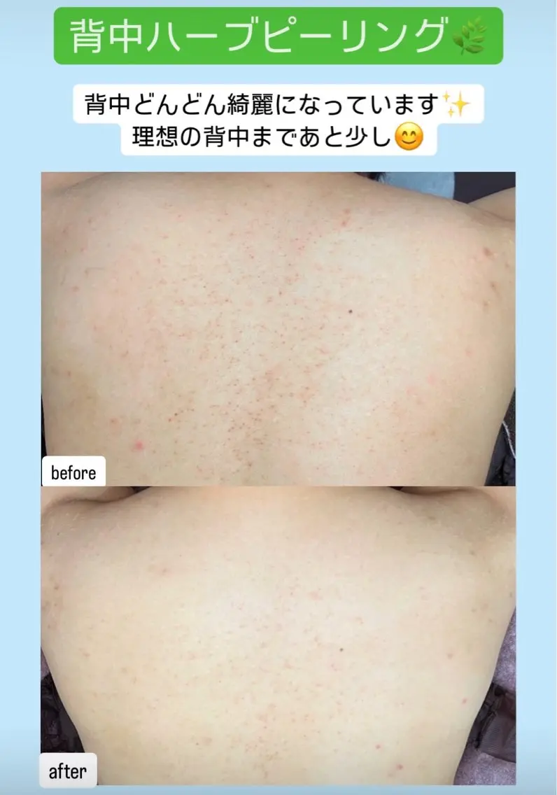 エステ ベラージュ【美背中・ 美尻・フェイシャル】のエステ・リラクイメージ