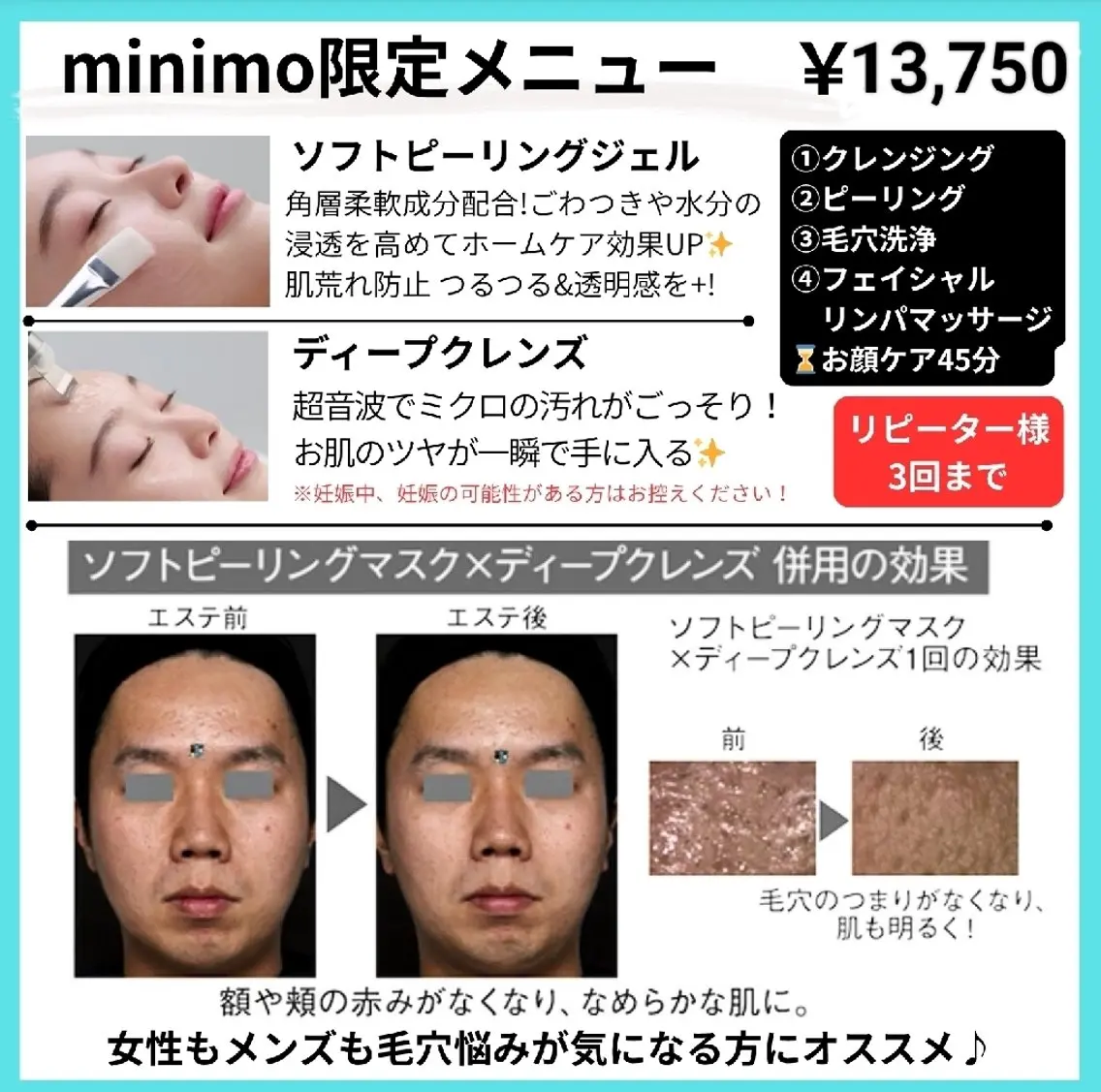 【メンズ限定】洗顔3ヶ月分付き♪毛穴洗浄フェイシャルコース🫧の写真