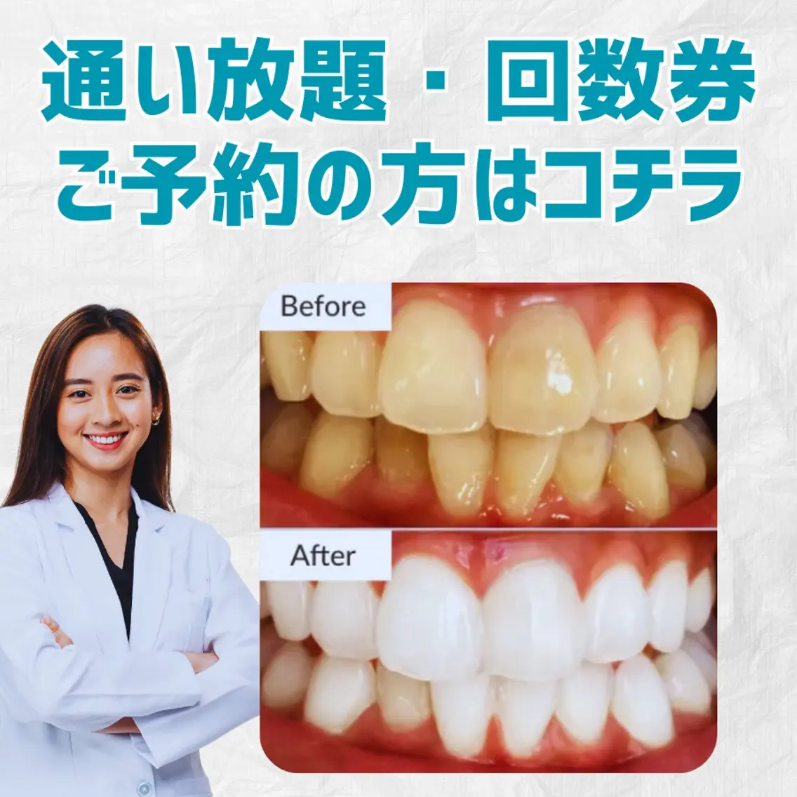 【1回4500円60分照射・回数券】お申込で医療提携ホワイトニング1回無料!の写真