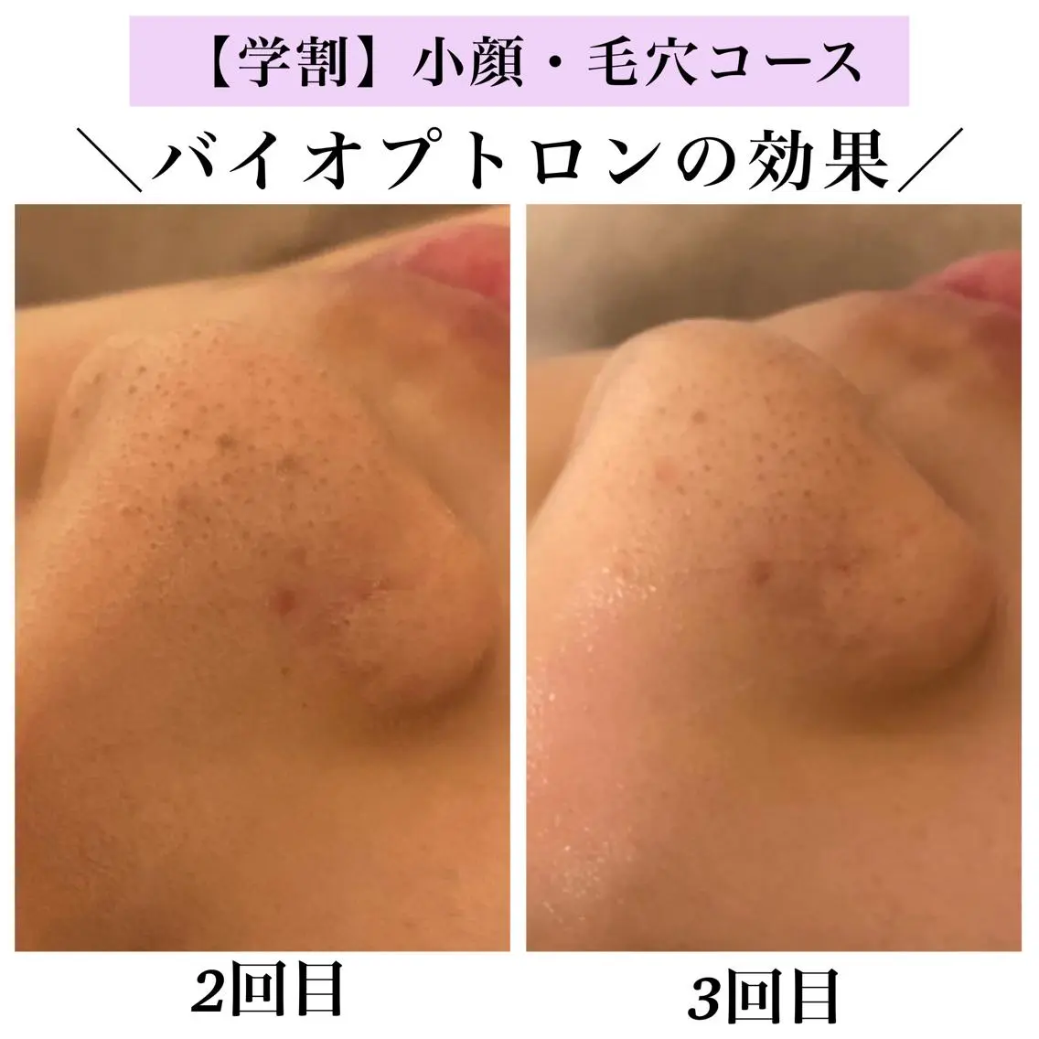 Bellesthe (ベルエステ)のエステ・リラクイメージ