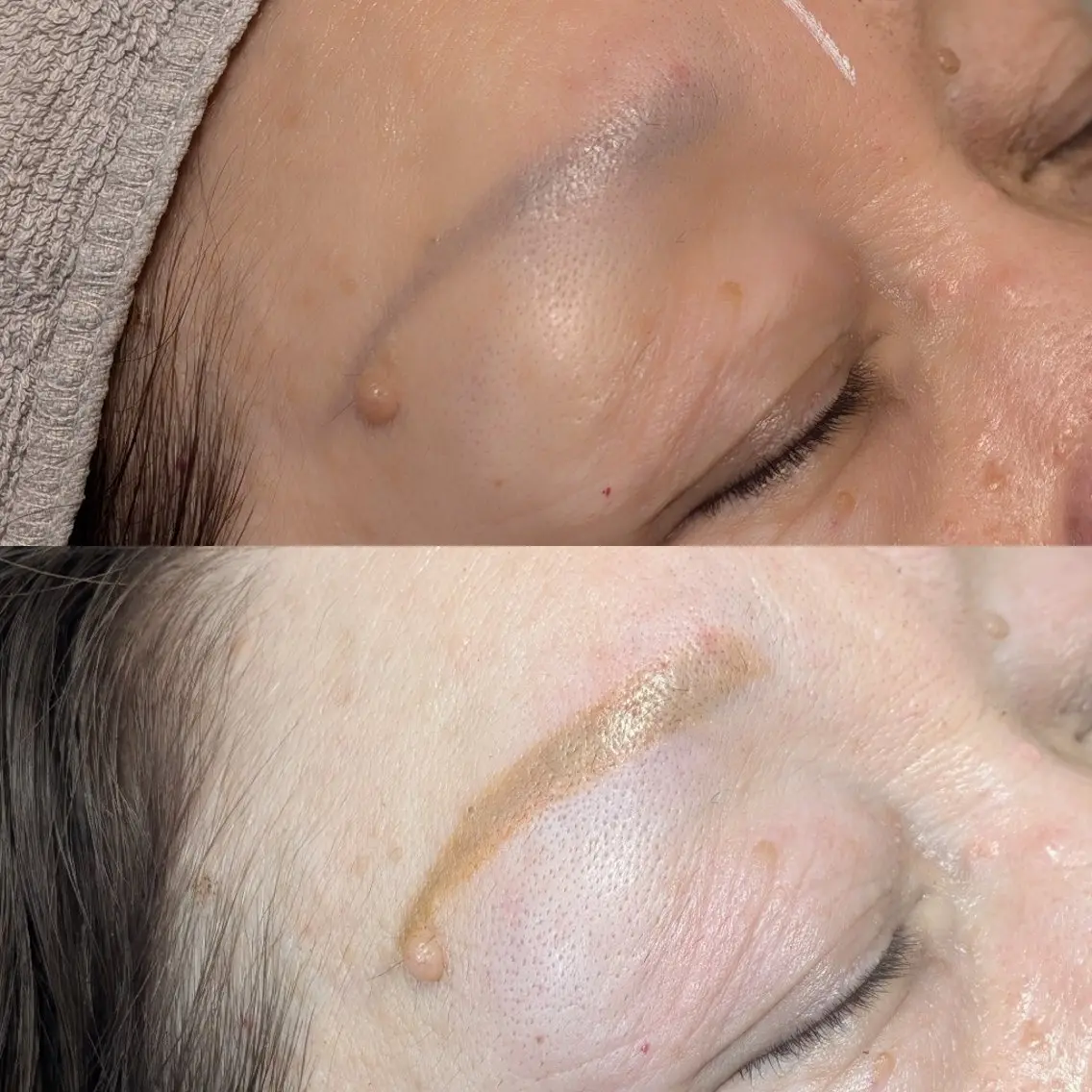 アイブロウ その他(アイブロウ) 眉迷子卒業🌿 眉WAX▶よしみの眉毛・アイブロウイメージ