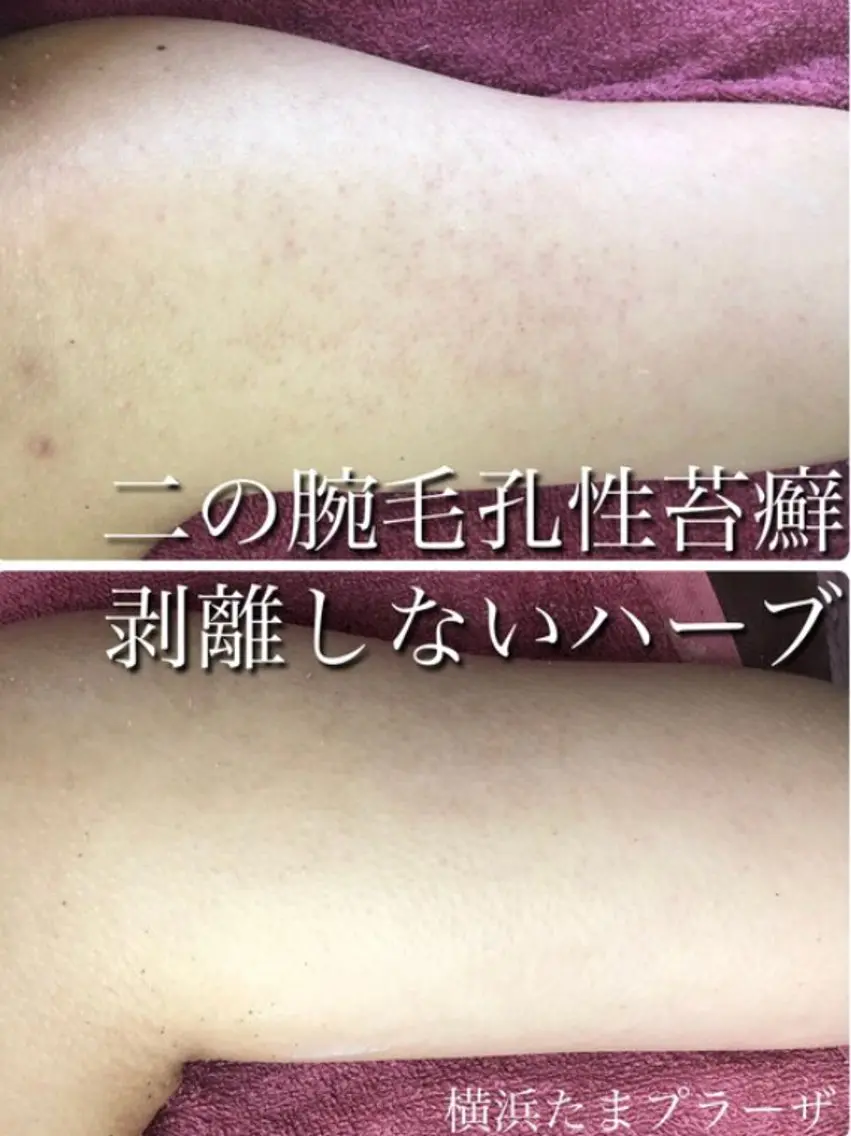エステ LILIANA ☆YURIのエステ・リラクイメージ