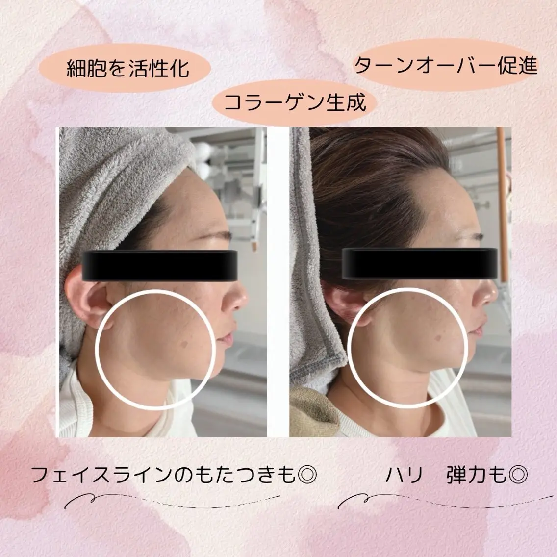 esthetic salon Ranのその他イメージ