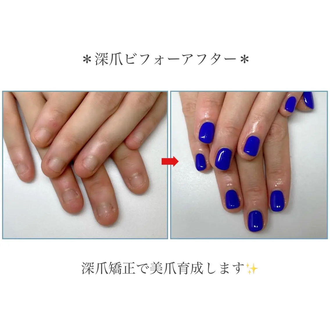 ネイル ネイルサロン アリュームのネイルデザイン