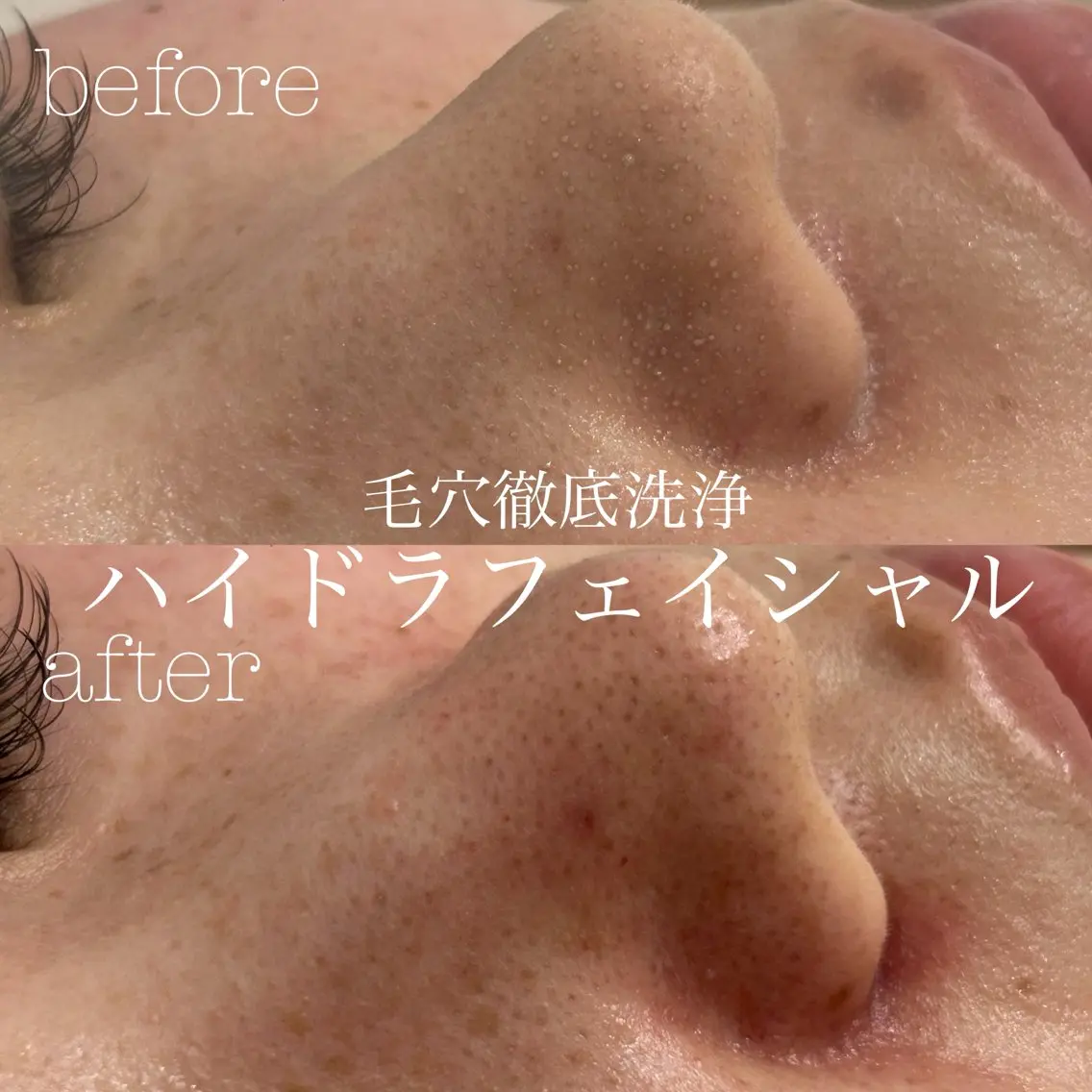 エステ フェイシャルサロン CHIARA 荒田のエステ・リラクイメージ