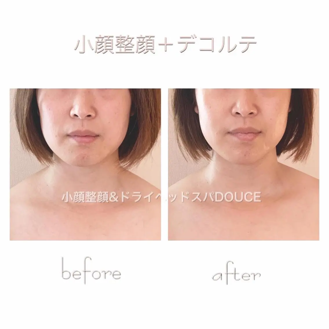 小顔＆ドライヘッド スパRe :setのエステ・リラクイメージ