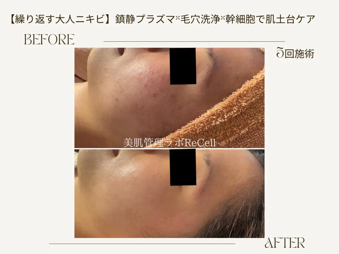 エステ ReCell 肌管理のエステ・リラクイメージ