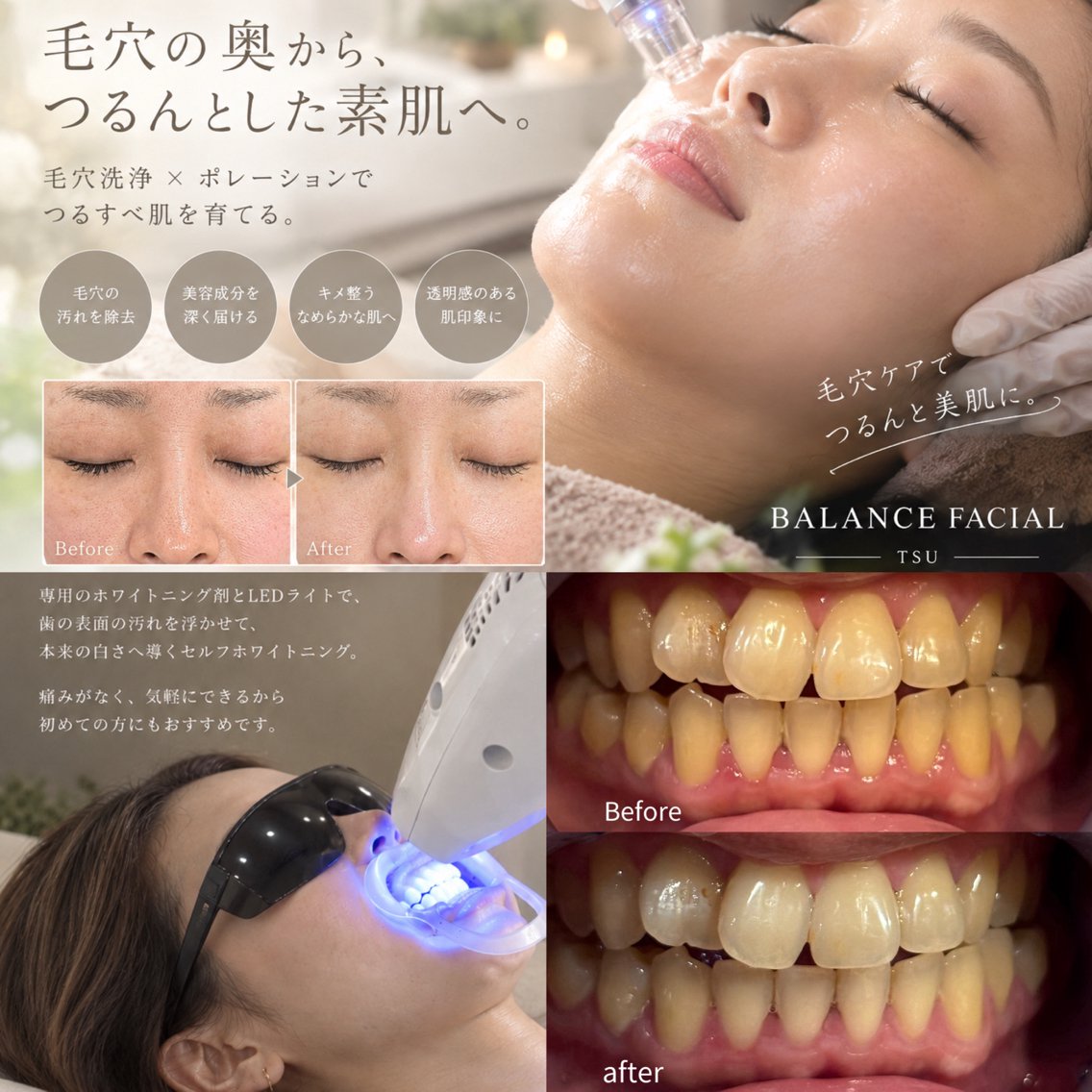 エステ Balance facialのその他イメージ