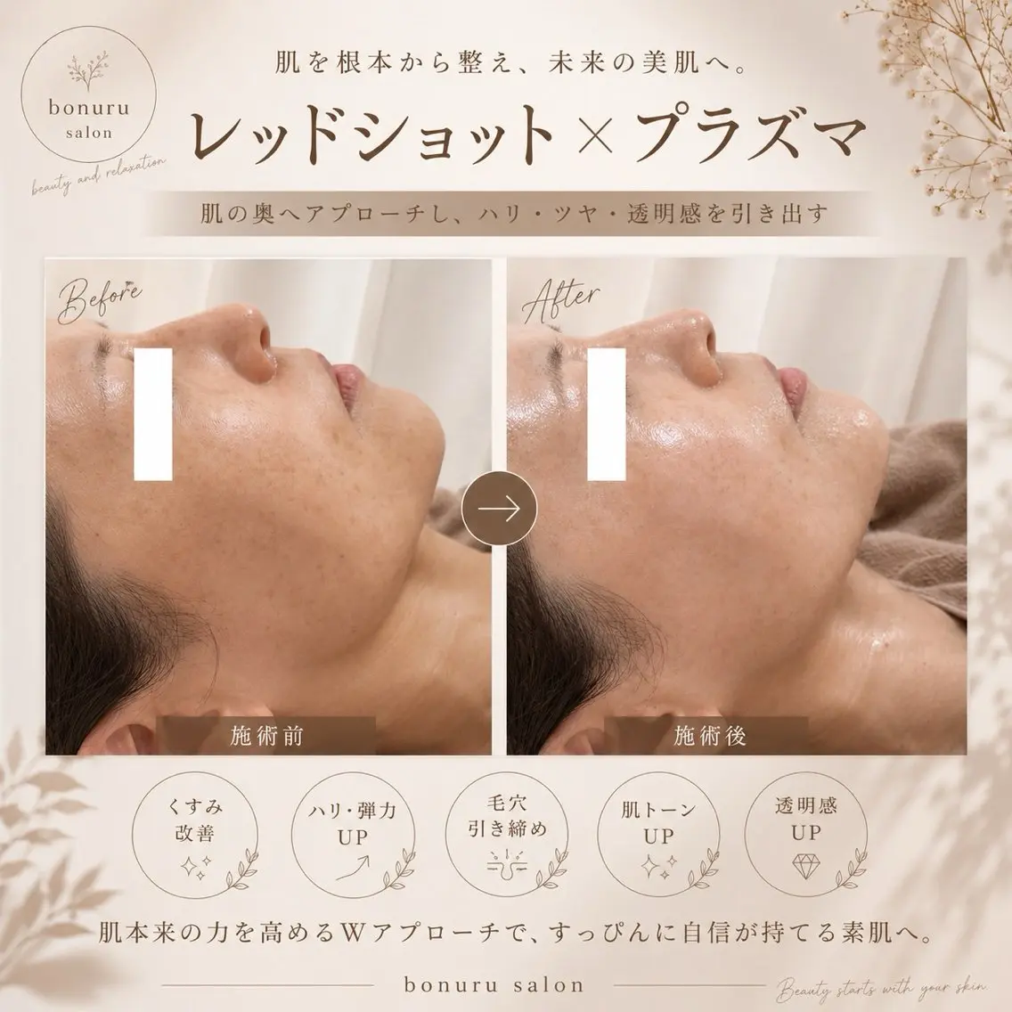 エステ bonuru salonのエステ・リラクイメージ