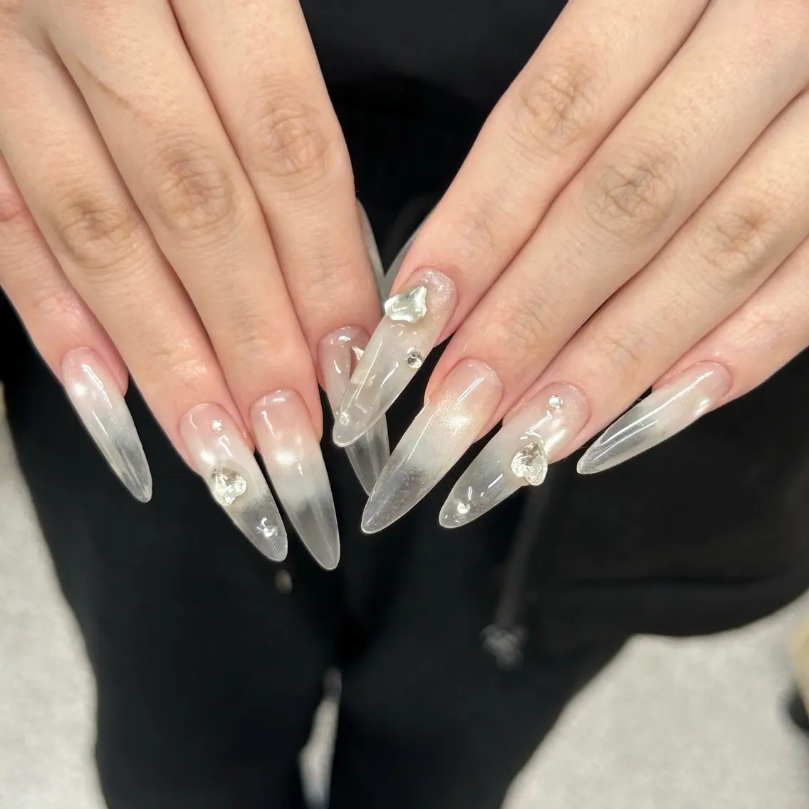 チップスカルプ➕パーツつけて放題の写真