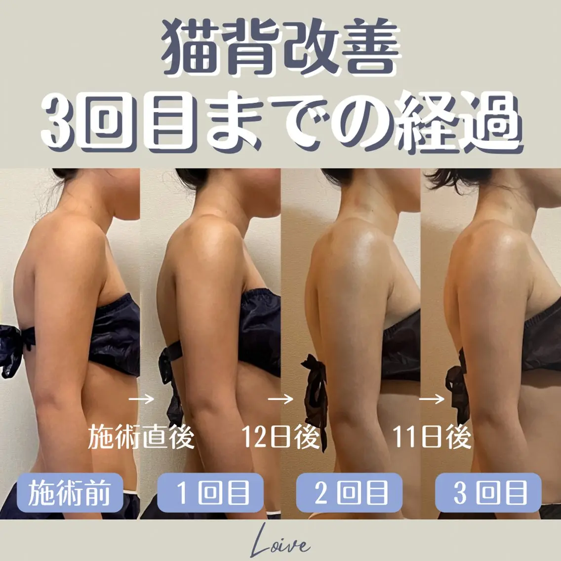エステ リラク 小顔矯正/骨格矯正 AKANEのエステ・リラクイメージ
