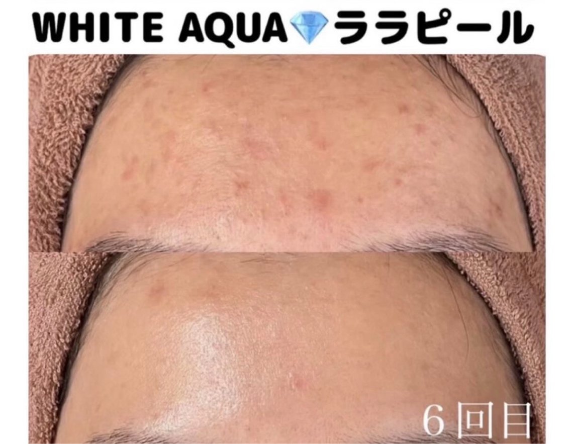 エステ 柏/肌管理専門店/ ⭐️サトウレノン🌟のエステ・リラクイメージ