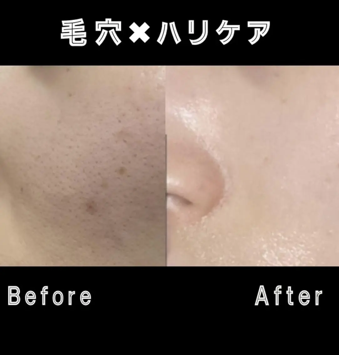🌷毛穴エステ レイビスMURA🌷のエステ・リラクイメージ