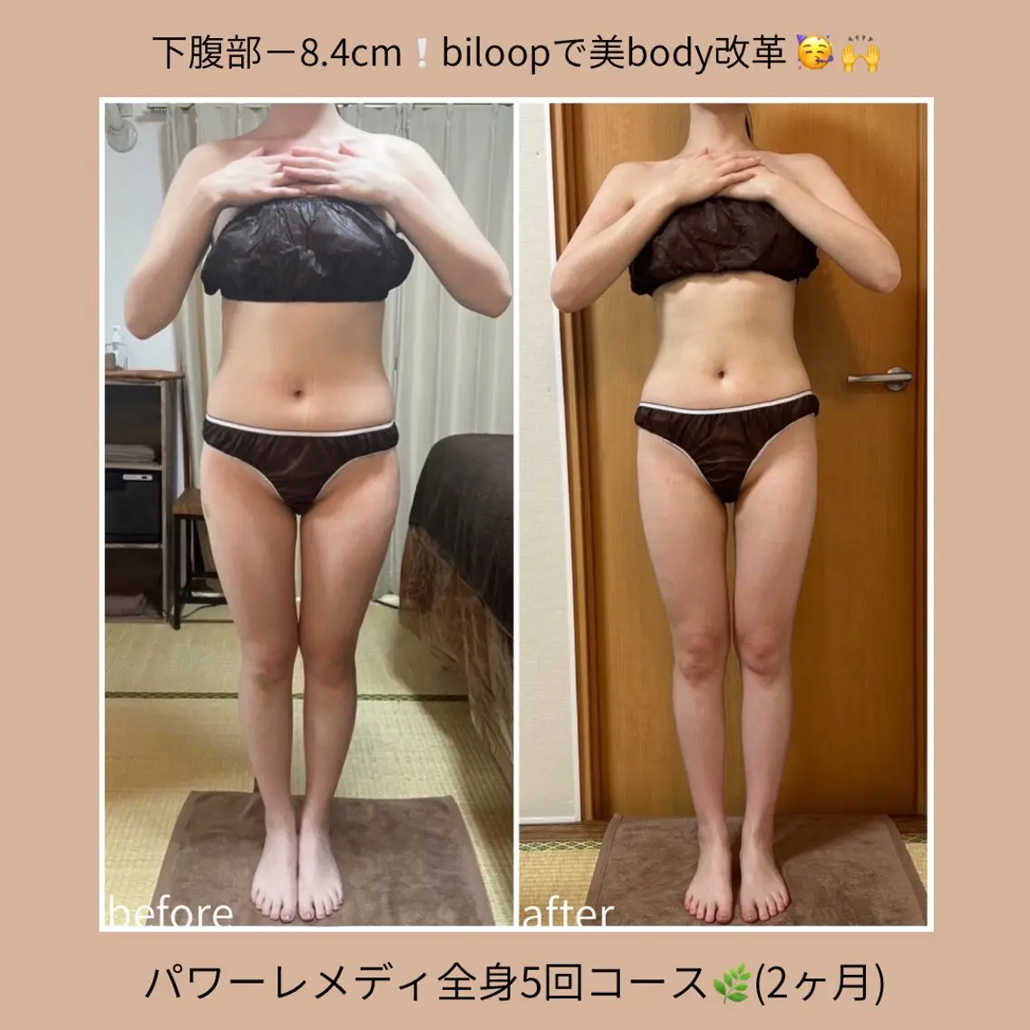 《本気痩せ×疲労改善 》  BILOOPのエステ・リラクイメージ