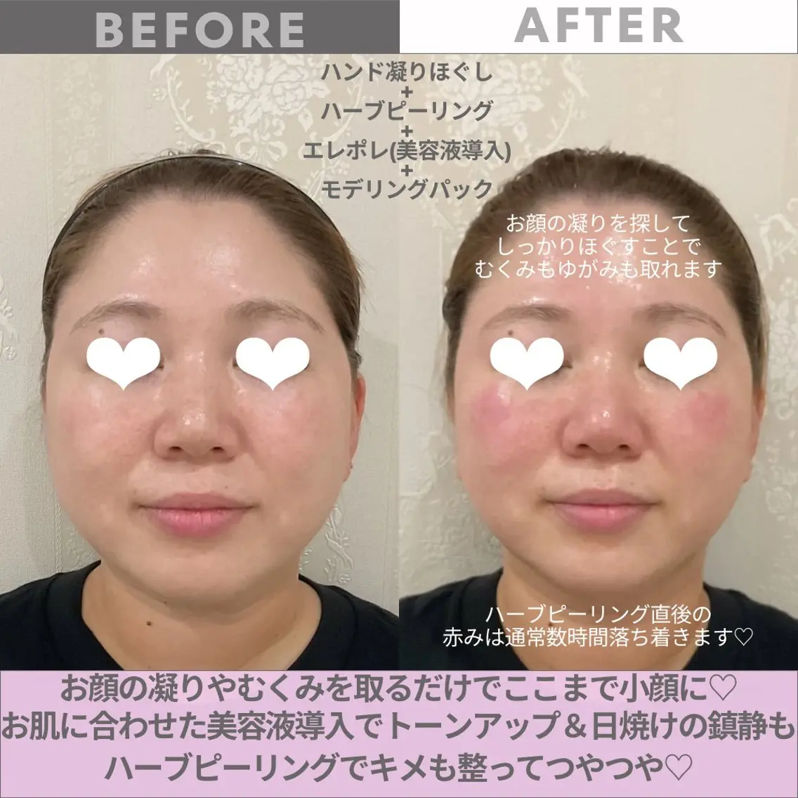 -３キロ⁈小顔、整顔マッサージの写真