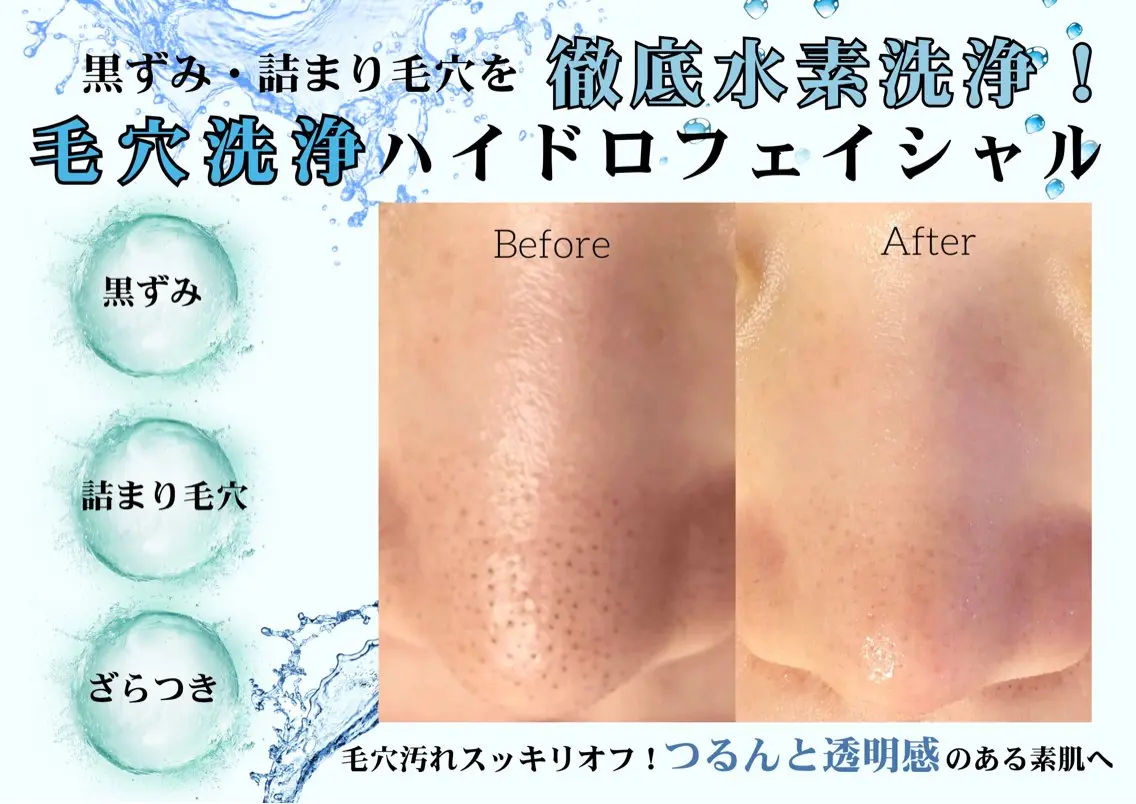 エステ 【肌質改善サロン】 LINDA西宮 AIのエステ・リラクイメージ