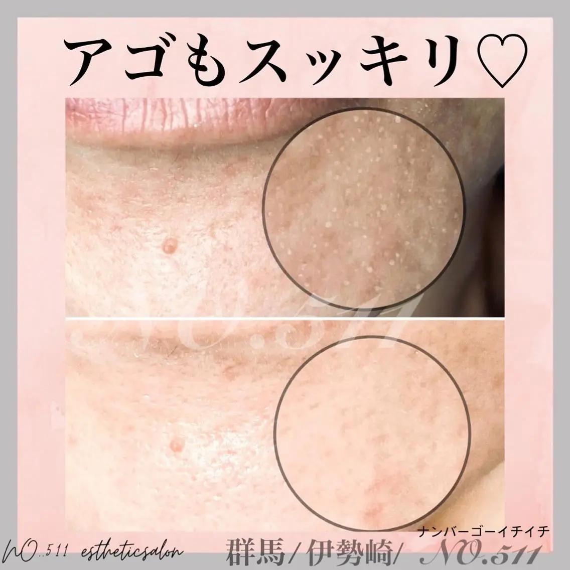 脱毛&フェイシャル NO.511のエステ・リラクイメージ