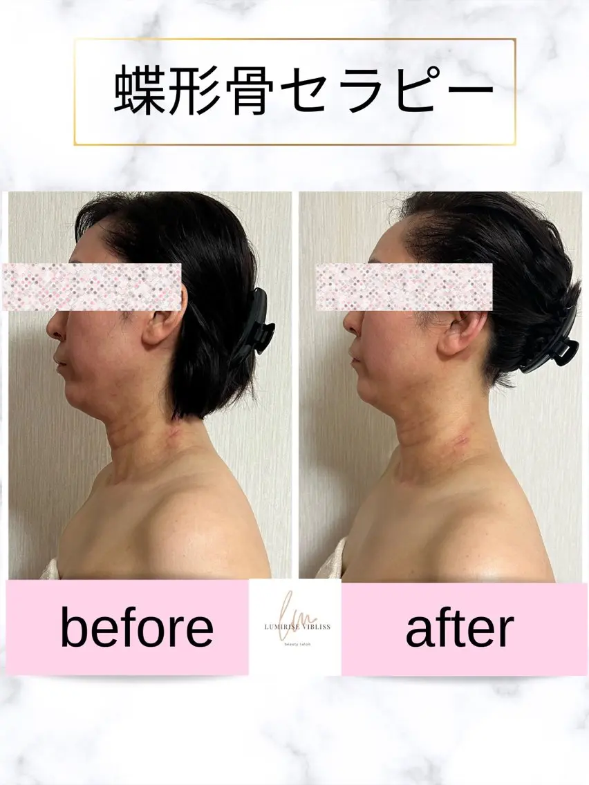 lumirise viblissのエステ・リラクイメージ