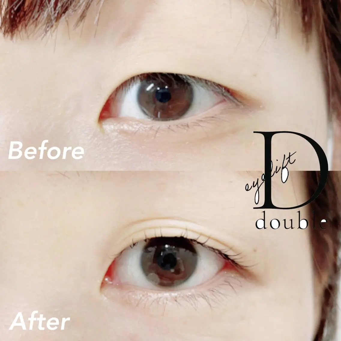 ダブルアイリフト《二重に近づけるパーマ》の写真