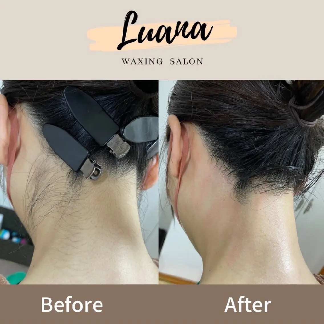 脱毛 Luana wax 🐚根本のエステ・リラクイメージ