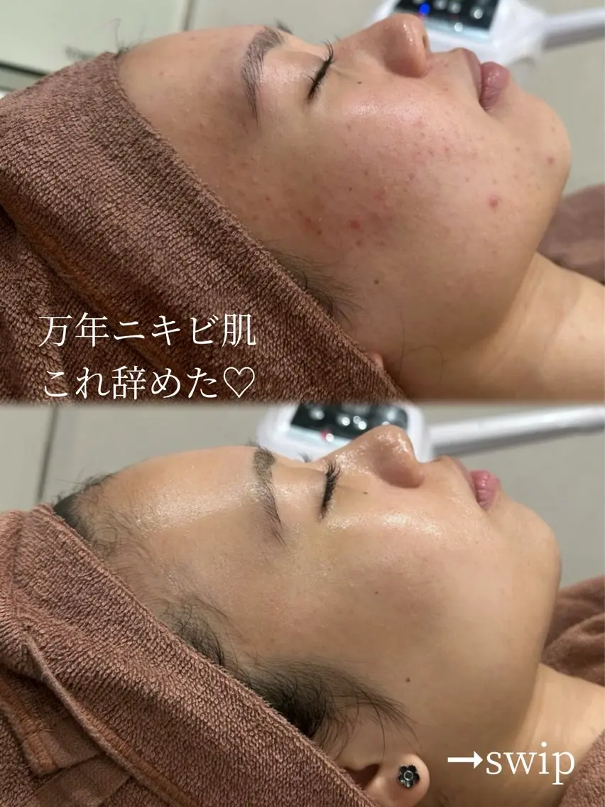 艶肌デトックス🫧 Samiraのエステ・リラクイメージ