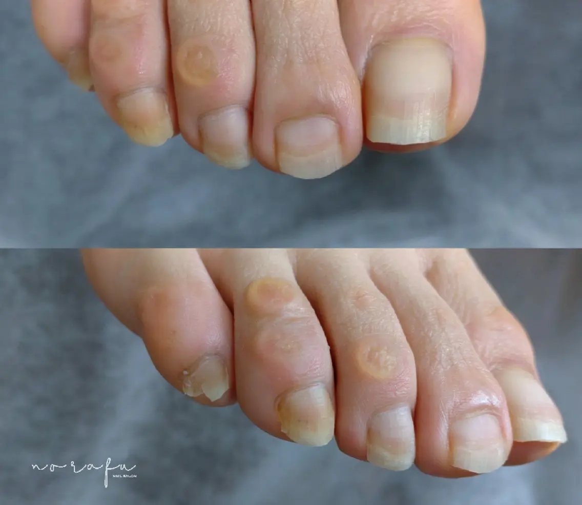 ネイル フットネイル nail 　norafu.のネイルデザイン