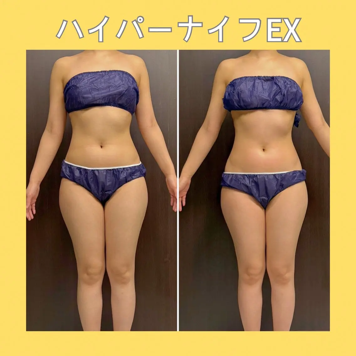 ハイパーナイフEXお好きな2パーツ当て放題❤️初めての方も安心👐気になるパーツだけケアしたい方に🔥の写真