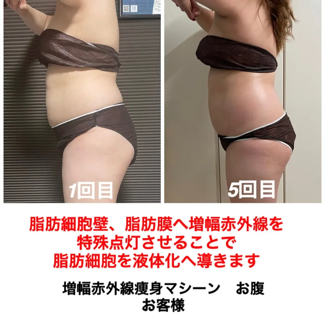 エステ ネイル・エステサロン UILANIのエステ・リラクイメージ