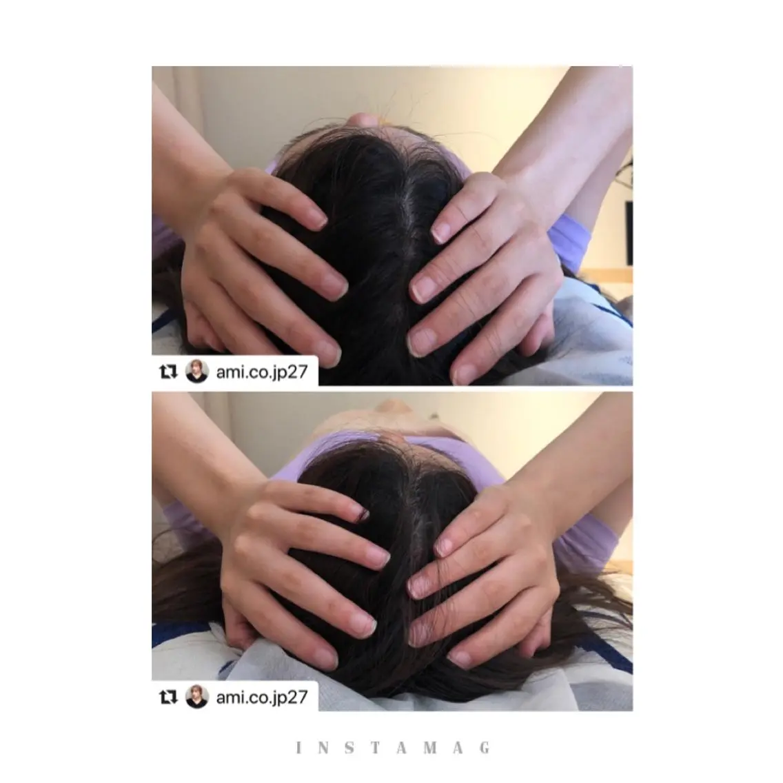 鍼灸 Refineのその他イメージ
