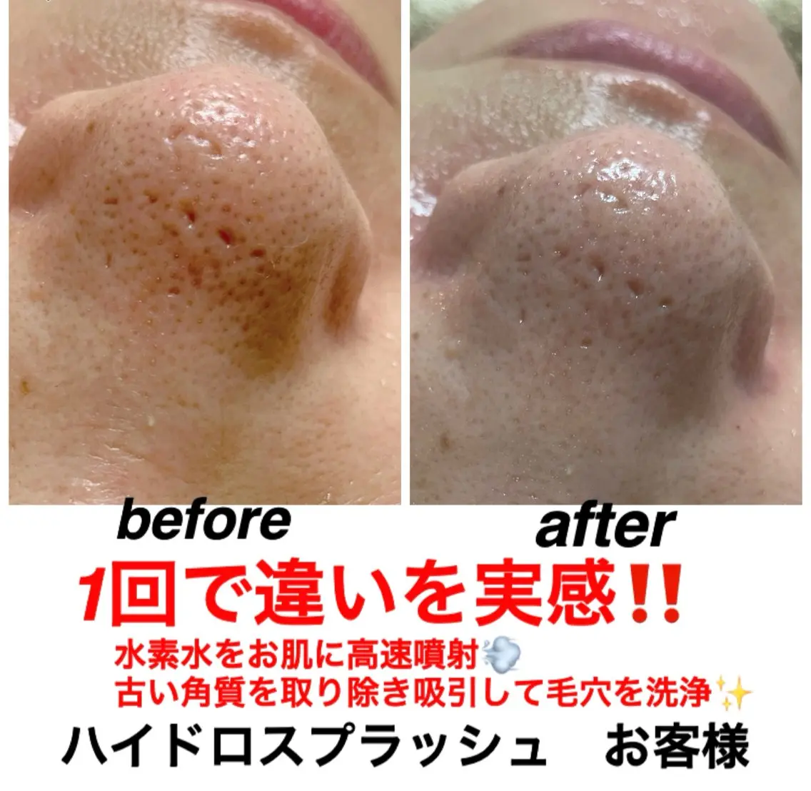 エステ リラク ネイル・エステサロン UILANIのエステ・リラクイメージ