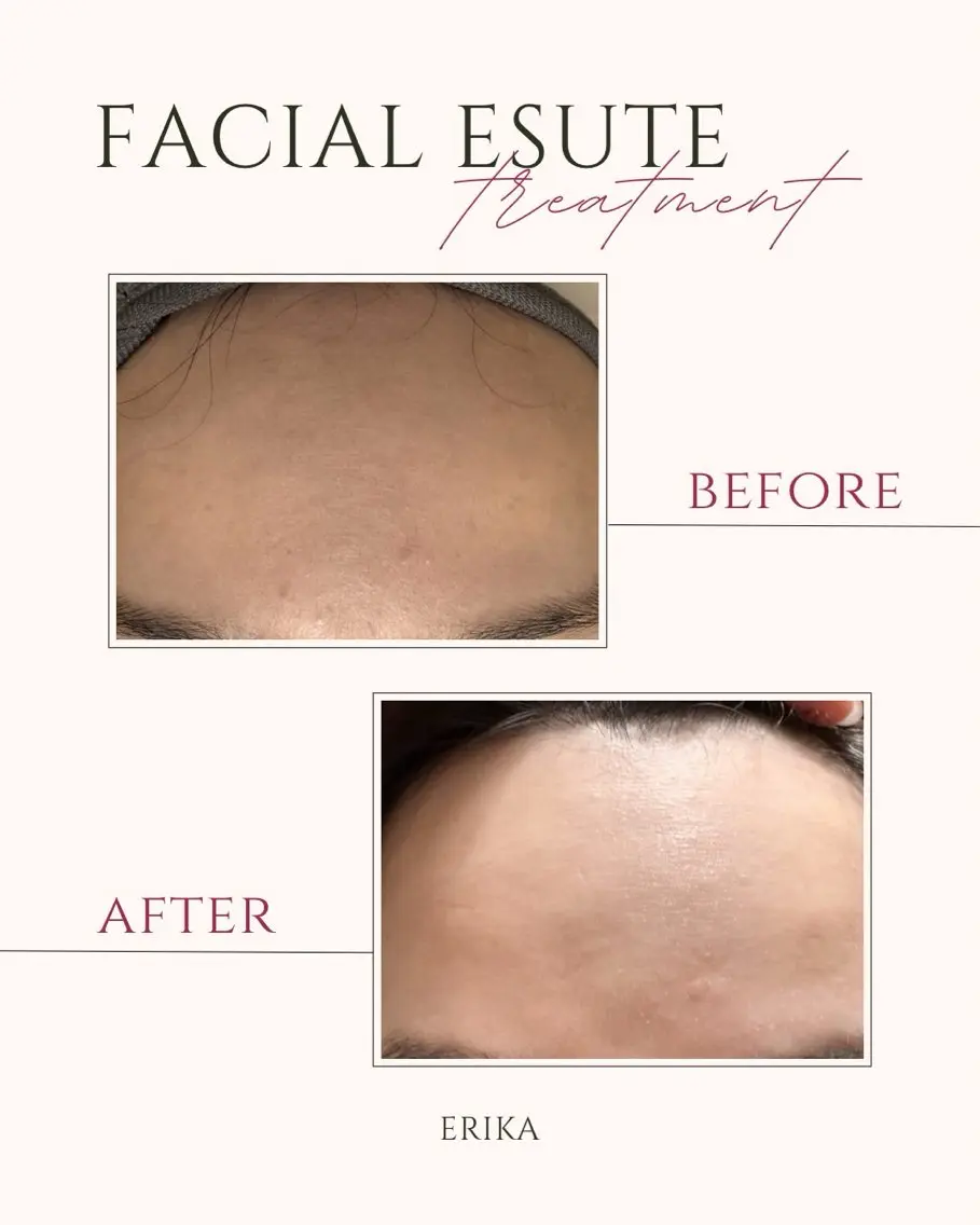 エステ BeutySalon ERIKAのエステ・リラクイメージ