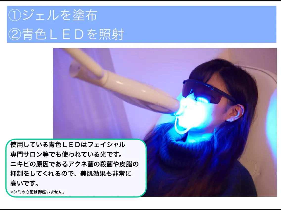 その他 ホワイトニングサロン nico西葛西店のその他イメージ