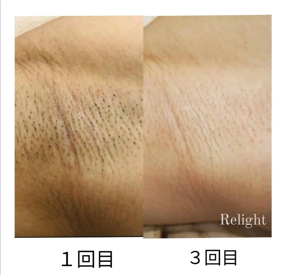 Relight あかりのエステ・リラクイメージ