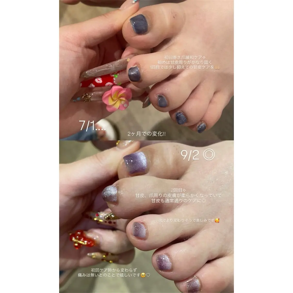 ネイル フットネイル RICO Nail パーツつけ放題🌈のネイルデザイン